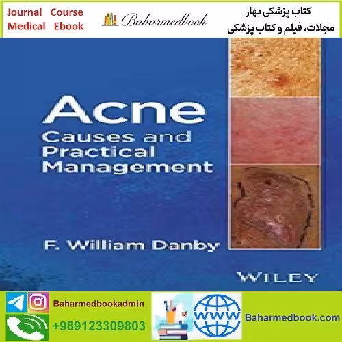 Acne Causes and Practical Management TRUE PDF price 1€ - کتاب پزشکی بهار
