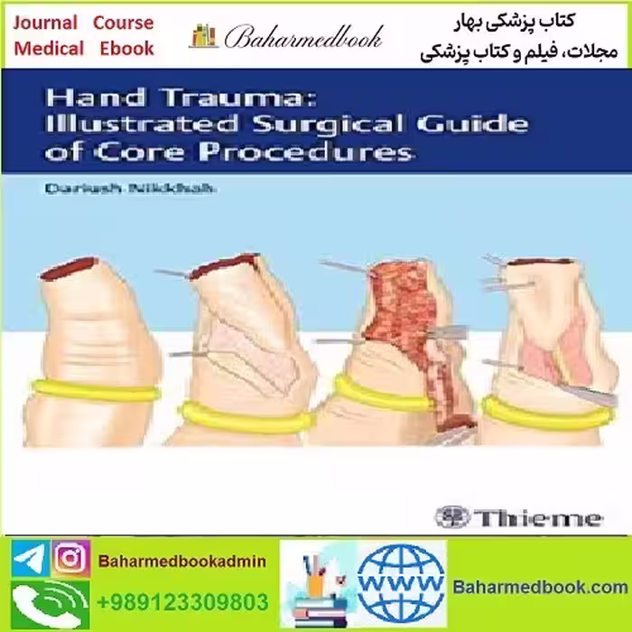 Hand Trauma Illustrated Surgical Guide of Core Procedures TRU