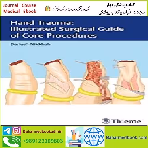 Hand Trauma Illustrated Surgical Guide of Core Procedures TRU