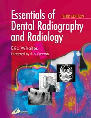 [PDF] دانلود کتاب Essentials Of Dental Radiography And Radiology, 3rd ed, 2002