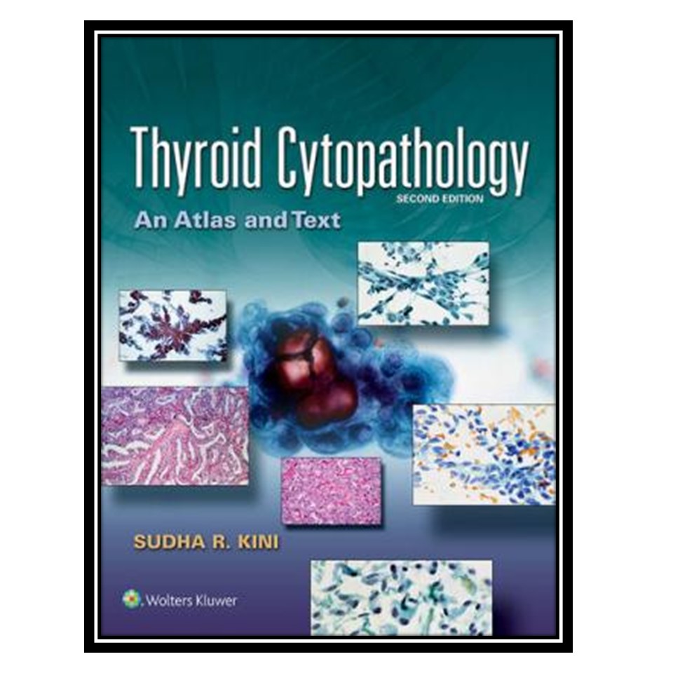 کتاب Thyroid Cytopathology اثر Sudha R Kini انتشارات مؤلفین طلایی