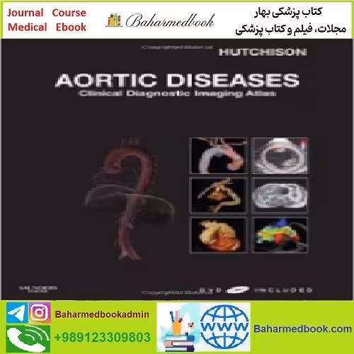 Aortic Diseases Clinical Diagnostic Imaging Atlas TRUE PDF pric