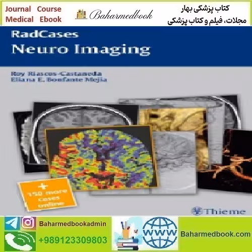 Neuro Imaging RadCases 2011 TRUE PDF price 1€ - کتاب پزشکی بهار