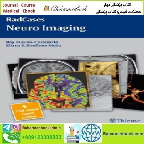 Neuro Imaging RadCases 2011 TRUE PDF price 1€ - کتاب پزشکی بهار