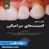 گام به گام لمینیت های سرامیکی