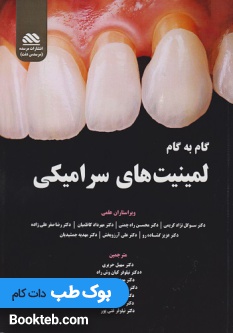 گام به گام لمینیت های سرامیکی