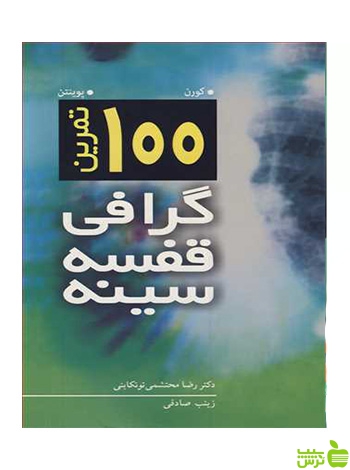 100 تمرین گرافی قفسه سینه پوینتن آییژ - سیب ترش - SibTorsh