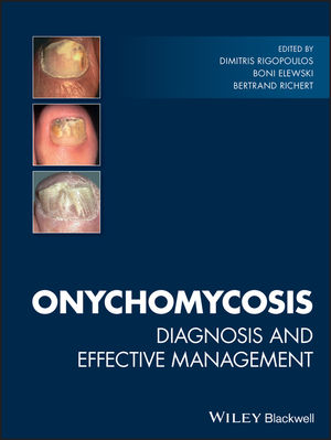 Onychomycosis: Diagnosis and Effective Management 2018 - کتاب پزشکی بهار