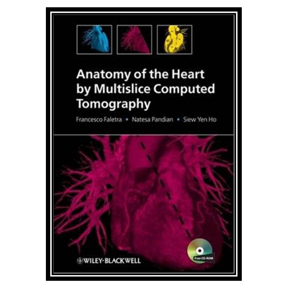 کتاب Anatomy of the Heart by Multislice Computed Tomography اثر جمعی از نویسندگان انتشارات مؤلفین طلایی