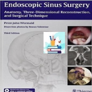 Endoscopic Sinus Surgery TRUE PDF price 1€