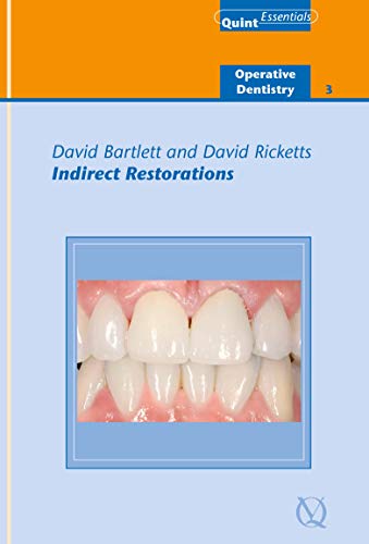  دانلود کتاب Indirect Restorations, 2019 - دانلود کتاب های دانشگاهی