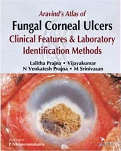 󾕇 دانلود کتاب Aravind'S Atlas Of Fungal Corneal Ulcers - Clinical Features And Laboratory Identification Methods, 2008 - دانلود کتاب های دانشگاهی