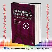 Fundamentals of Implant Dentistry : Prosthodontic Principles