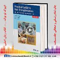 Practical Guide to Hair Transplantation
