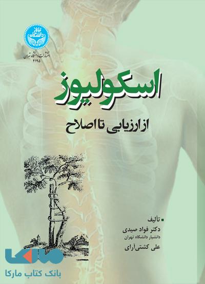 اسکولیوز (از ارزیابی تا اصلاح) نشر دانشگاه تهران