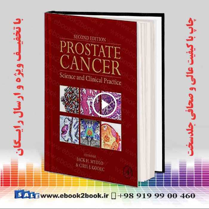 Prostate Cancer: Science and Clinical Practice 2nd Edition