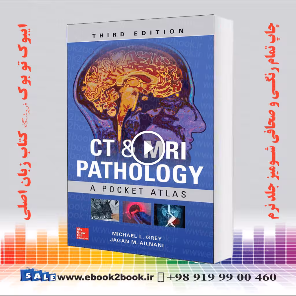 CT and MRI Pathology: A Pocket Atlas, 3rd Edition