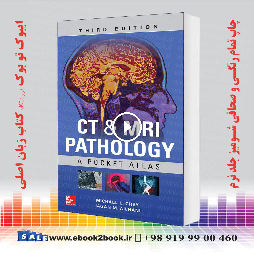 CT and MRI Pathology: A Pocket Atlas, 3rd Edition