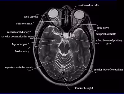 MRI Mastery Series Brain Anatomy Course-Video Price 15€ - کتاب پزشکی بهار