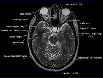 MRI Mastery Series Brain Anatomy Course-Video Price 15€ - کتاب پزشکی بهار