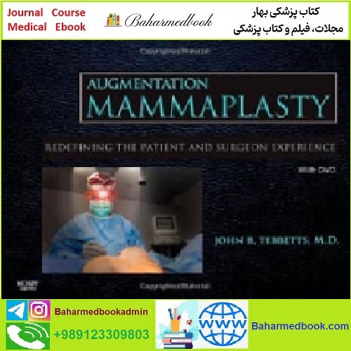 Augmentation Mammaplasty TRUE PDF price 1€