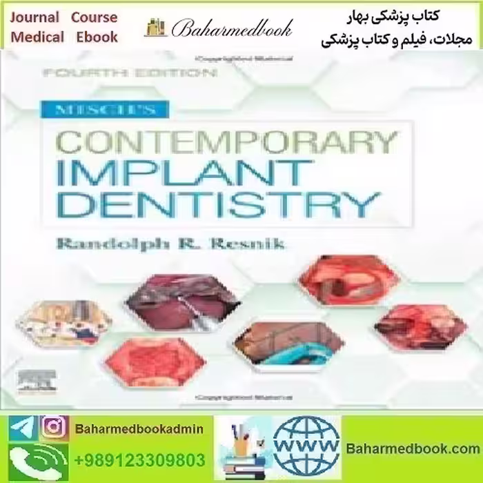 Misch's Contemporary Implant Dentistry 2021 TRUE PDF price 1€ - کتاب پزشکی بهار