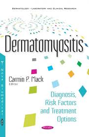 Dermatomyositis: Diagnosis, Risk Factors and Treatment Options 2017 - کتاب پزشکی بهار