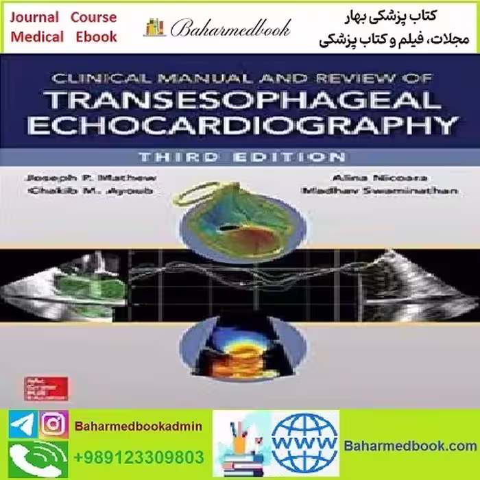 Clinical Manual and Review of Transesophageal Echocardiography