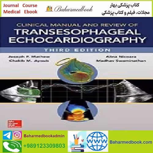 Clinical Manual and Review of Transesophageal Echocardiography