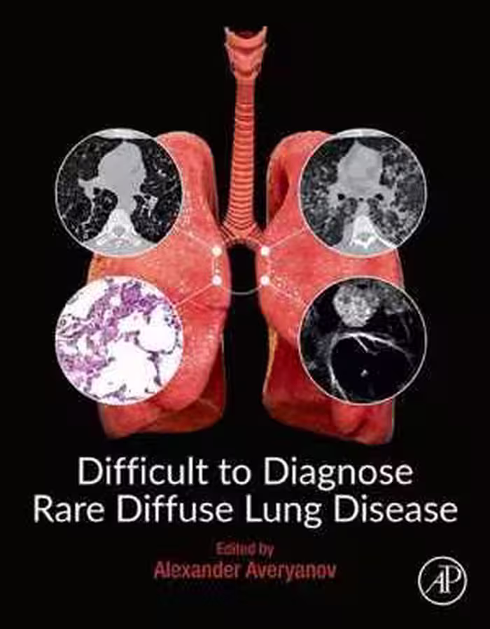 [PDF] دانلود کتاب Difficult To Diagnose Rare Diffuse Lung Disease, 2019