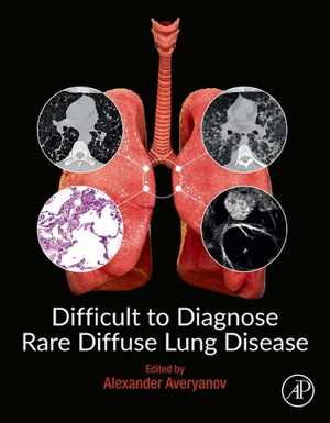 [PDF] دانلود کتاب Difficult To Diagnose Rare Diffuse Lung Disease, 2019