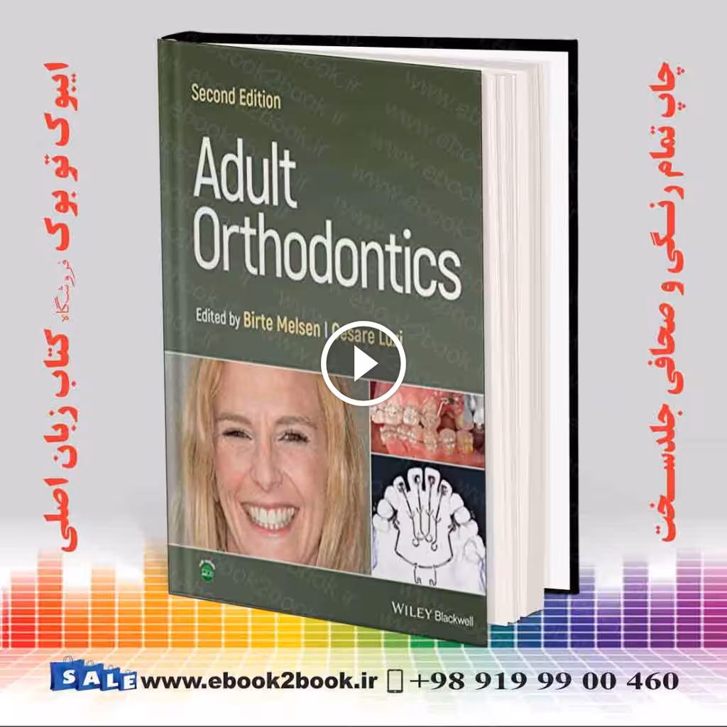 Adult Orthodontics 2nd Edition