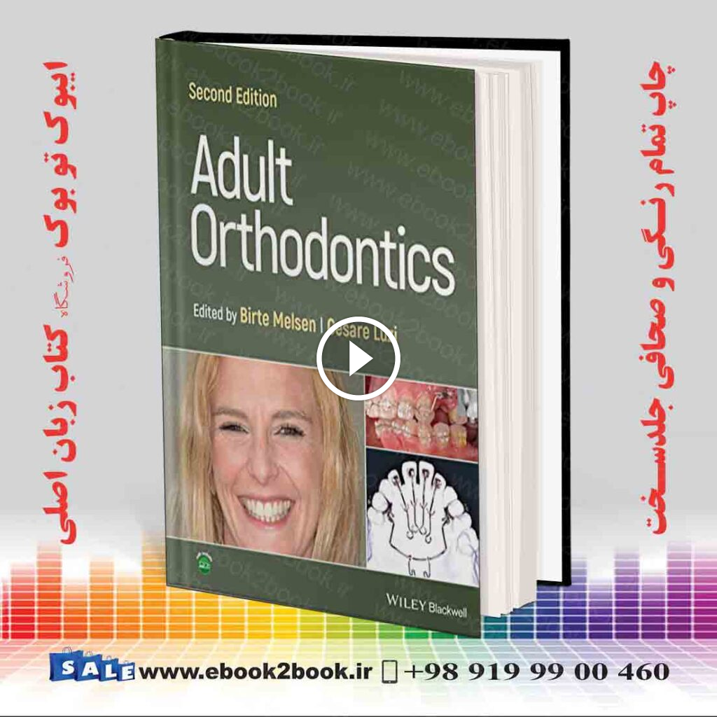 Adult Orthodontics 2nd Edition