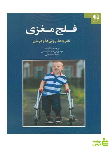 فلج مغزی شيلا شبديني دانژه - سیب ترش - SibTorsh