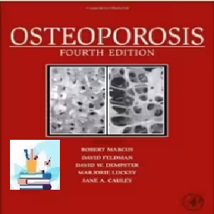 Osteoporosis TRUE PDF price 1€