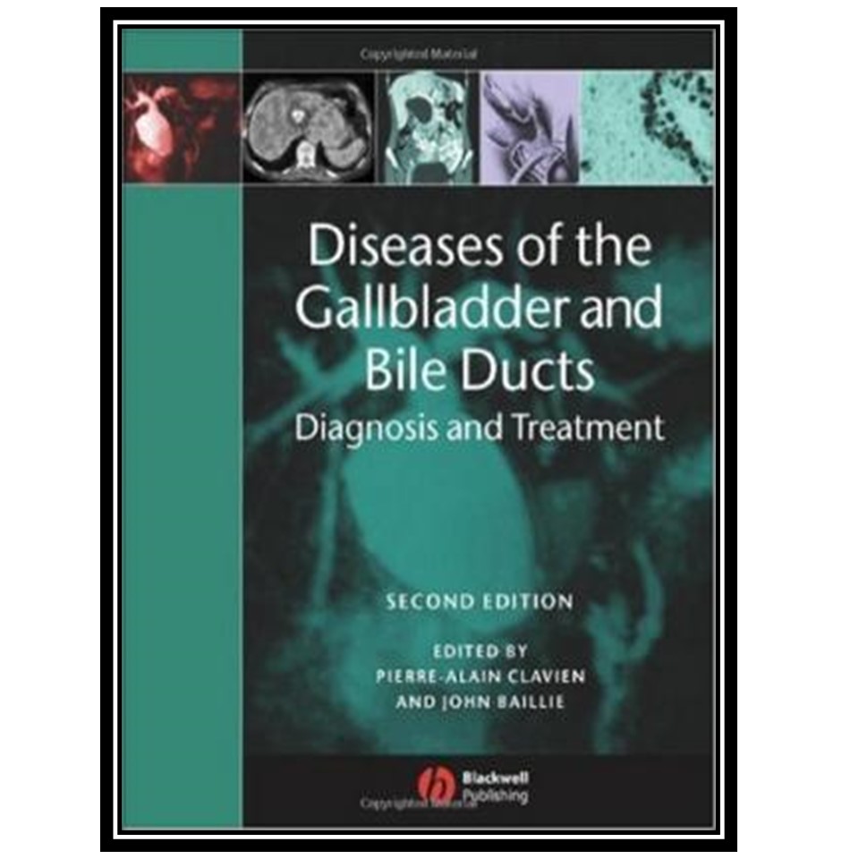 کتاب Diseases of the Gallbladder and Bile Ducts: Diagnosis and Treatment اثر Pierre-Alain Clavien انتشارات مؤلفین طلایی