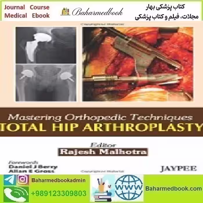 Total Hip Arthroplasty Mastering Orthopedic