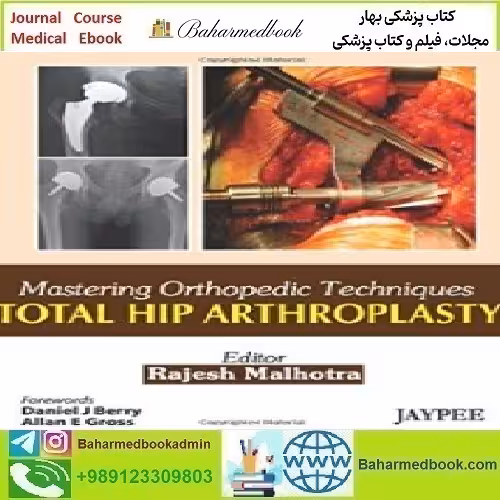 Total Hip Arthroplasty Mastering Orthopedic