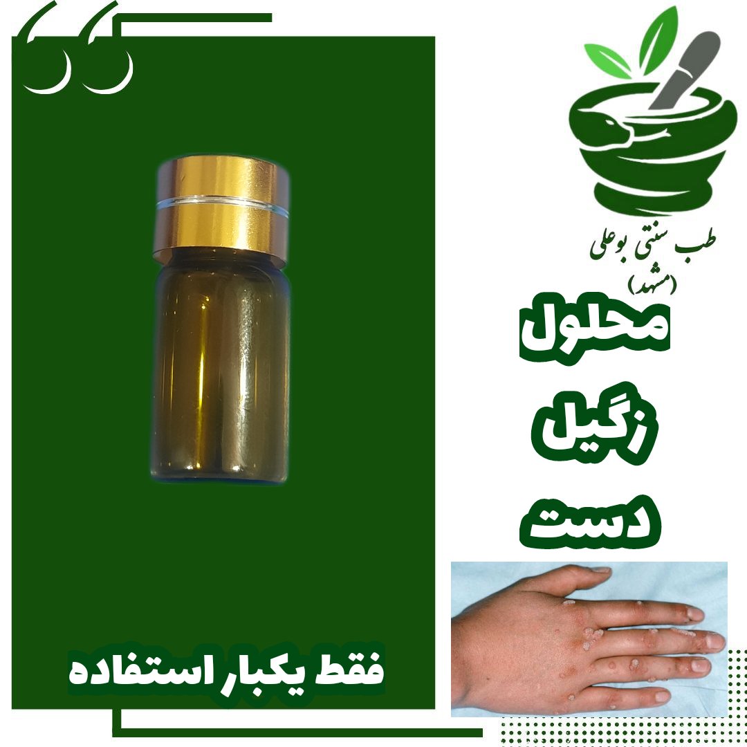 محلول زگیل دست برداشت فقط یکبار استفاده گیاهی دستساز پرستار شبانی زیگیل ذگیل طب سنتی بوعلی مشهد ریمو حذف
