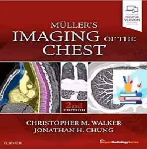 Muller's Imaging of the Chest TRUE PDF price 1€
