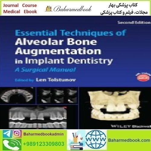 Essential Techniques of Alveolar Bone Augmentation