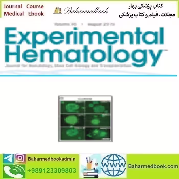Experimental Hematology Volume 77 2019 TRUE PDF price 4€ - کتاب پزشکی بهار