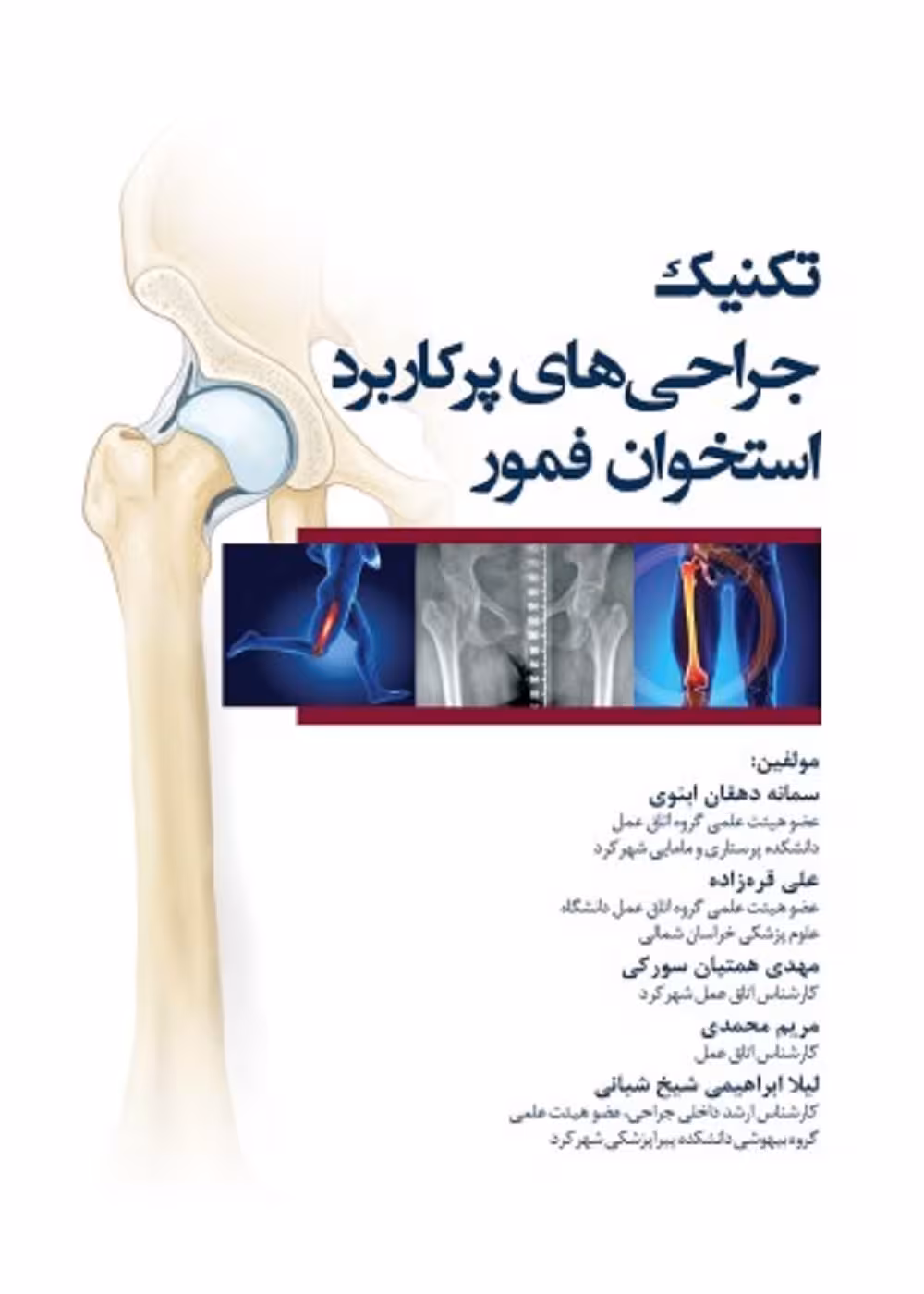 تکنیک جراحی های پرکاربرد استخوان فمور