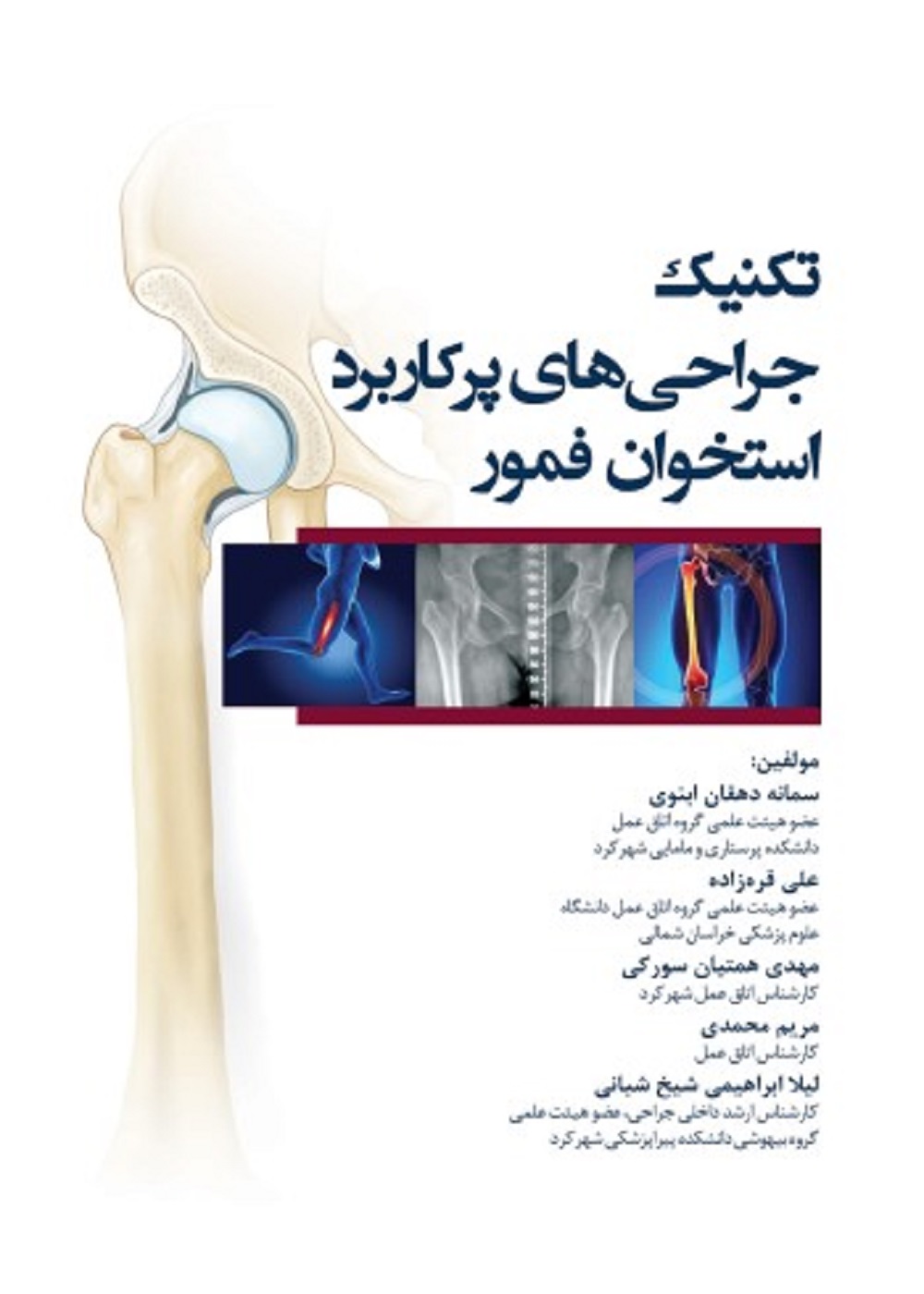 تکنیک جراحی های پرکاربرد استخوان فمور