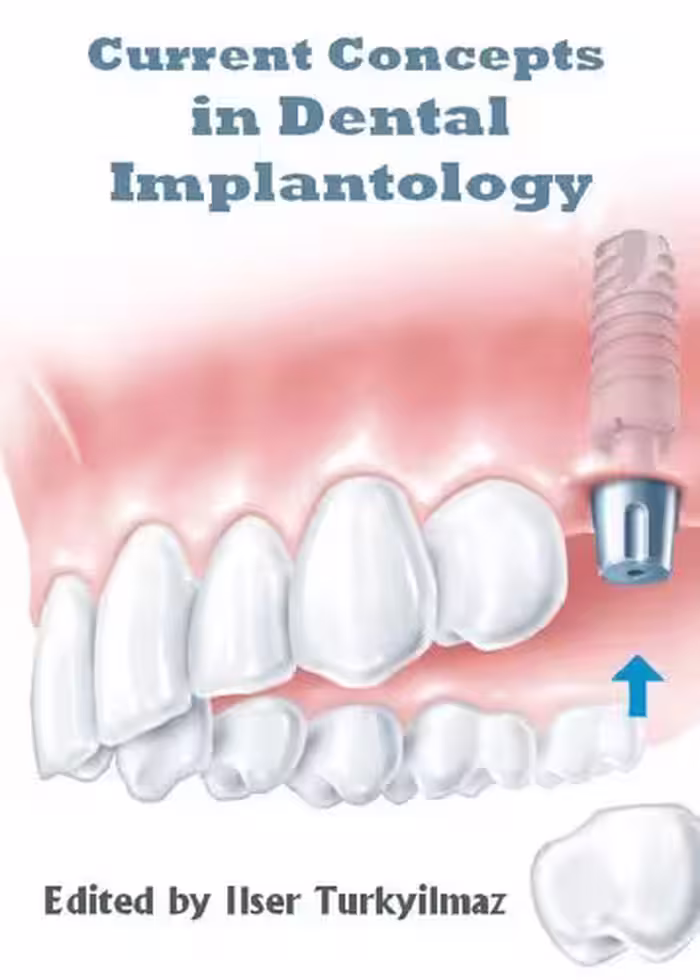 󾕇 دانلود کتاب Current Concepts In Dental Implantology, 2015 - دانلود کتاب های دانشگاهی
