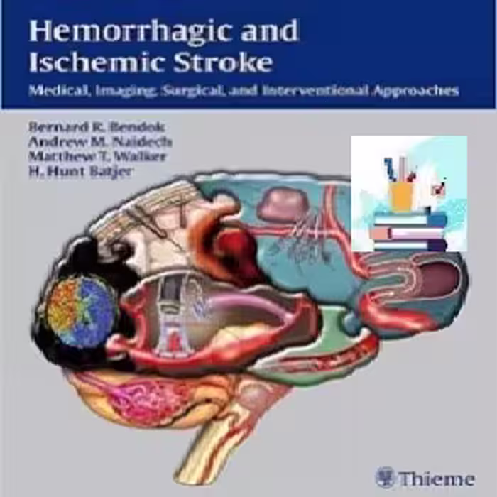 Hemorrhagic and Ischemic Stroke TRUE PDF price 1€