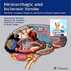 Hemorrhagic and Ischemic Stroke TRUE PDF price 1€