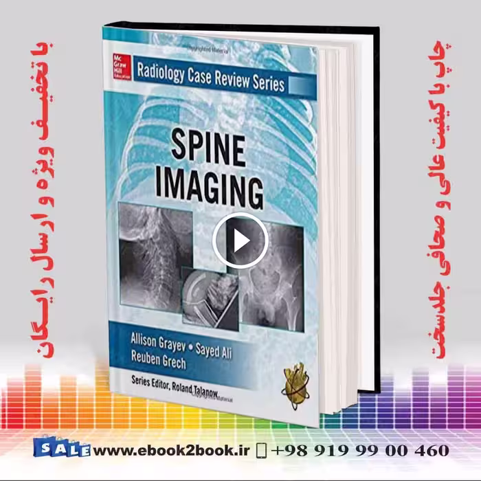 تصویربرداری ستون فقرات | Radiology Case Review Series: Spine
