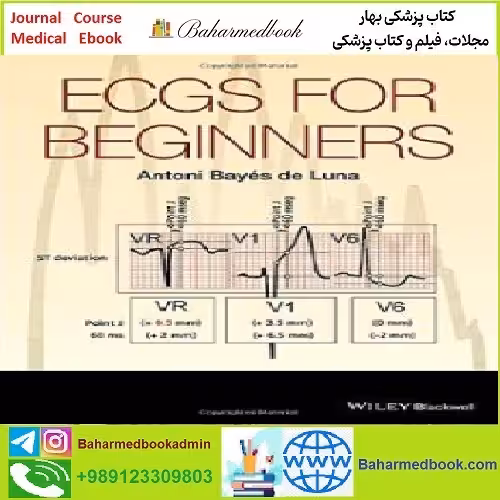ECGs for Beginners TRUE PDF price 1€ - کتاب پزشکی بهار