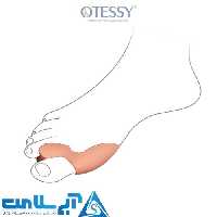 پد فاصله دهنده دو انگشتی otessy